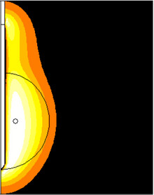 Numerical Validation of the Efficiency of Dual-Frequency Radiofrequency ...